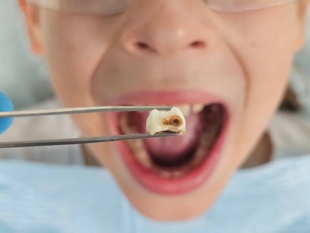 Best Emergency Pediatric Dental Care in Hillcrest, CA